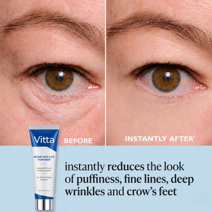 Vitta Derm™ Instant Face Temporary Tightener – Instant visible results in 60 seconds