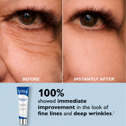 Vitta Derm™ Instant Face Temporary Tightener – Instant visible results in 60 seconds