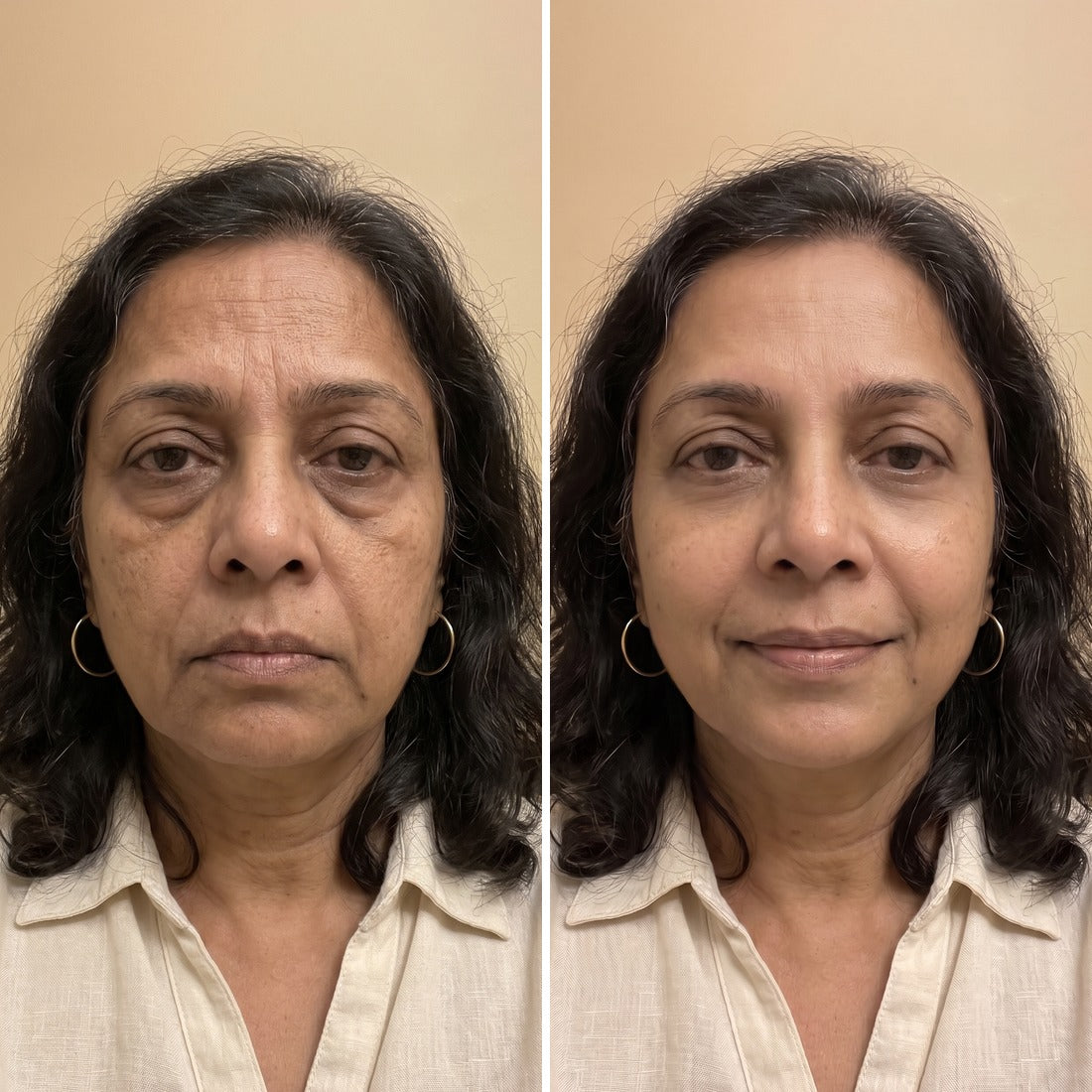 Meera L. before and after Vitta
