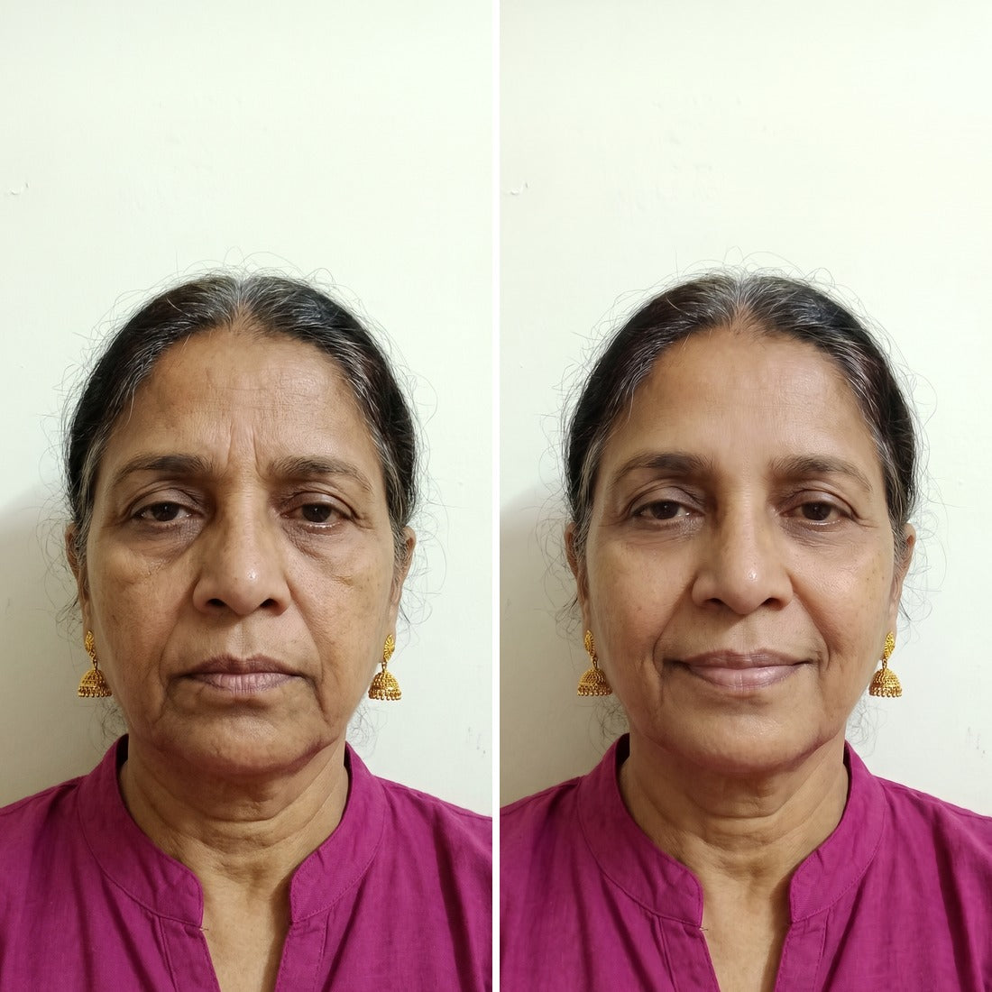 Anjali R. before and after Vitta