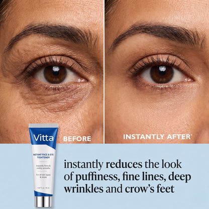 Before and after under-eye — Vitta India