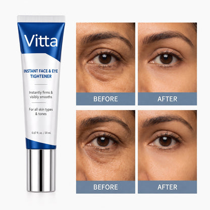Before and after eye area — Vitta India