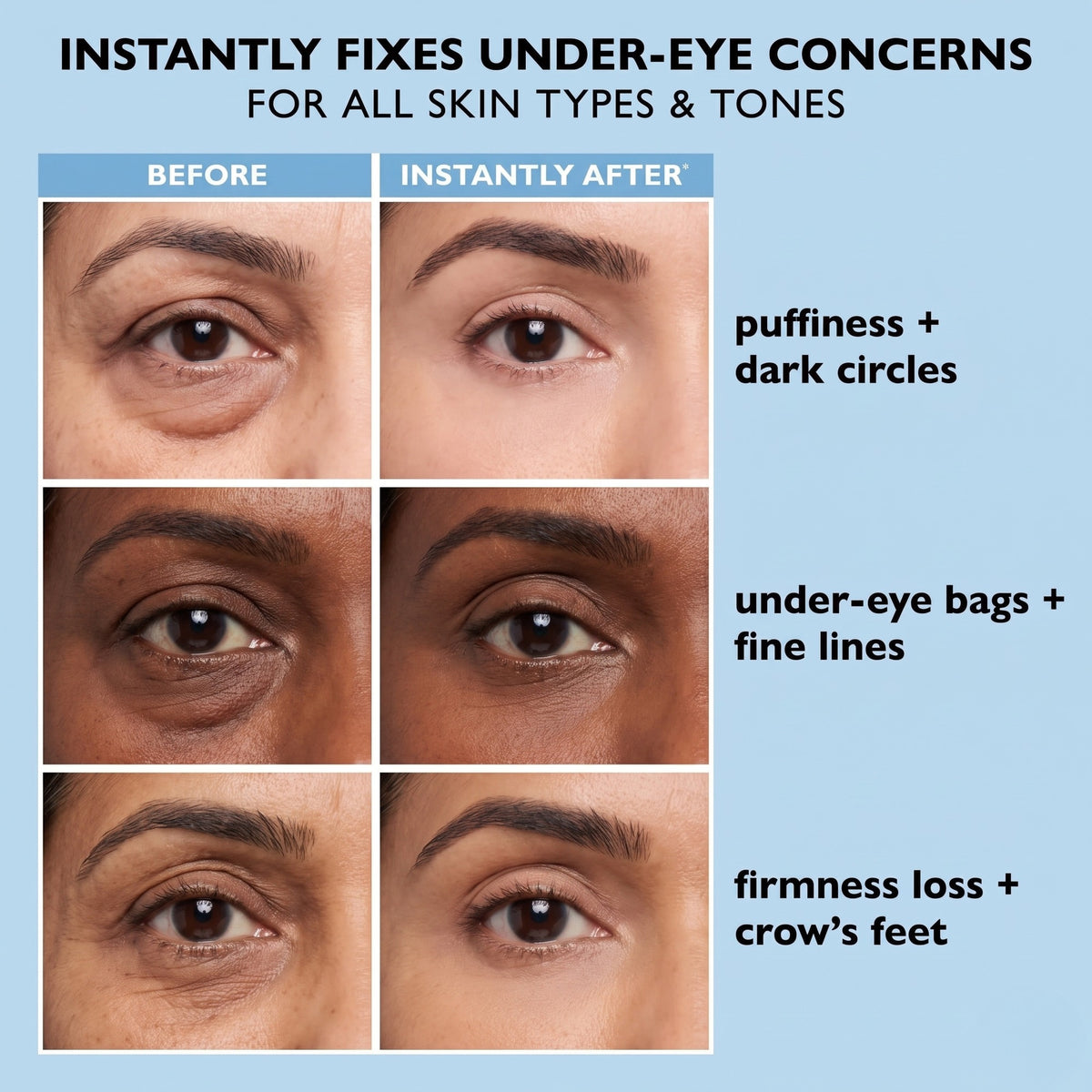 t25_undereye